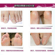 new-baby-exfoliating-foot-mask-peeling-renewal-remove-dead-skin-cuticles-feet-care-py1 BBL