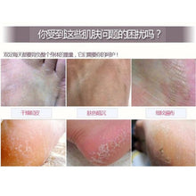 new-baby-exfoliating-foot-mask-peeling-renewal-remove-dead-skin-cuticles-feet-care-py1 BBL