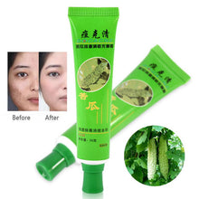 30g-acne-cream-blain-products-desalt-blain-to-imprint-face-cream-face-treatment BBL