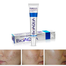 30g-aloe-plant-extract-acne-scar-remove-whitening-antibacterial-ointment-face-skin-care-cream BBL