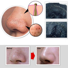 50ml-blackhead-remover-deep-cleansing-purifying-peel-off-acne-black-mud-face-mask BBL