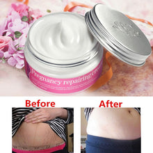 afy-no-side-effects-pregnancy-repair-cream-stretch-mark-remover-maternity-relieve-fat-grain-skin-care-py8 BBL