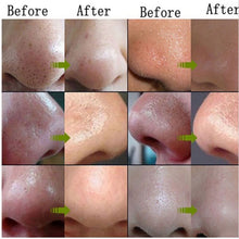 afy-skin-care-suction-black-mask-bamboo-charcoal-blackhead-remover-nose-face-facial-mask-tearing-peeling-shrink-pores-l4 BBL