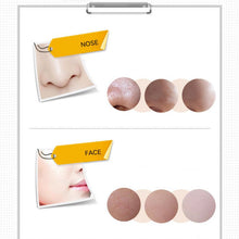 black-head-acne-treatments-face-care-suction-mask-nose-blackhead-remover-peeling-peel-off-facial-mask-py7 BBL
