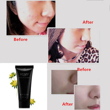 face-mask-suction-black-head-peel-masks-deep-cleansing-tearing-blackhead-remover-purifying BBL