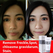 fade-dark-spots-face-mask-whitening-and-spot-removal-products-moisturizing-exfoliator-anti-wrinkle-skin-care-masks-40g BBL