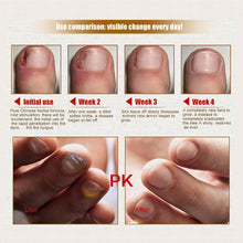 health-skin-care-herbal-nail-repair-treatment-essential-oil-onychomycosis-remover-serum-beauty-disinfect-l4 BBL