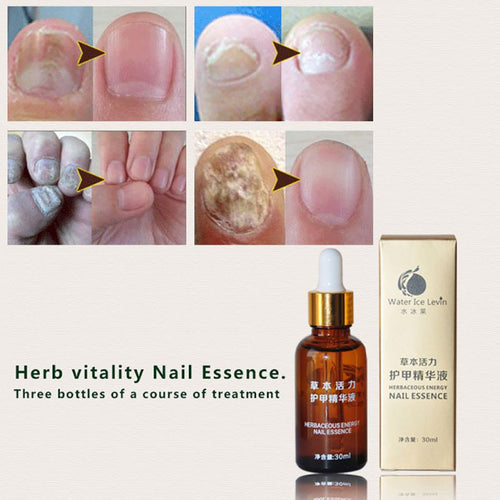 health-skin-care-herbal-nail-repair-treatment-essential-oil-onychomycosis-remover-serum-beauty-disinfect-l4 BBL