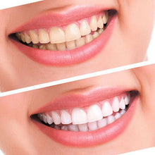 teeth-whitening-44-peroxide-dental-bleaching-system-oral-gel-kit-tooth-whitener-dental-equipment BBL