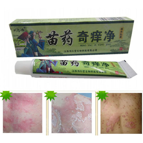 net-herbal-itch-cream-fungal-infections-foot-and-ringworm-balanitis-hemorrhoids-anti-itch-body-creams BBL
