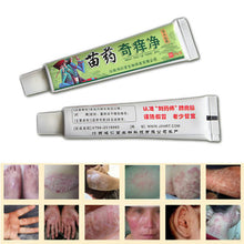 net-herbal-itch-cream-fungal-infections-foot-and-ringworm-balanitis-hemorrhoids-anti-itch-body-creams BBL
