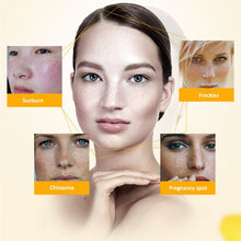new-women-face-skin-whitening-remove-freckle-speckle-peel-dark-spot-wrinkles-cream BBL