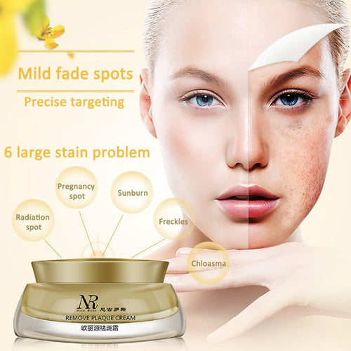 new-women-face-skin-whitening-remove-freckle-speckle-peel-dark-spot-wrinkles-cream BBL