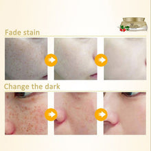 new-women-face-skin-whitening-remove-freckle-speckle-peel-dark-spot-wrinkles-cream BBL