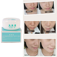 powerful-whitening-freckle-cream-remove-melasma-acne-spots-pigment-melanin-face-care-cream-l4 BBL